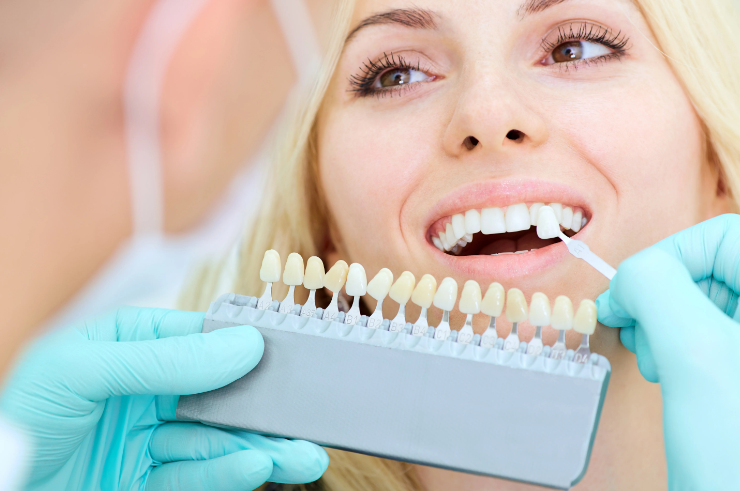 Teeth Whitening Techniques
