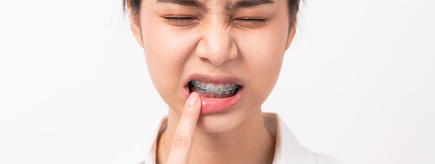 How Diet Affects Dental Hygiene and Oral Health