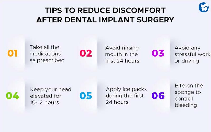 Post-Implant Care: Essential Tips for Maintaining Your Dental Implants