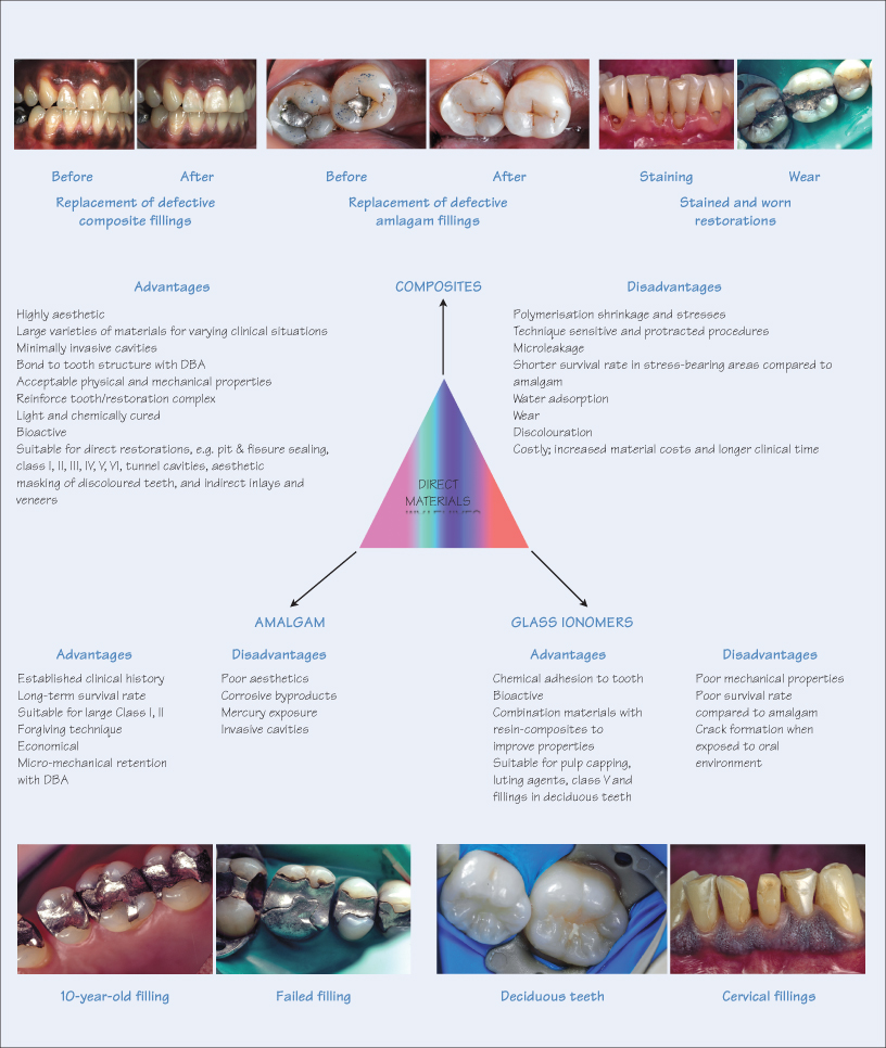 Choosing the Right Material for Your Dental Restorations