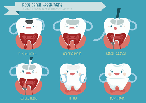 Understanding the Causes of Root Canal Failure