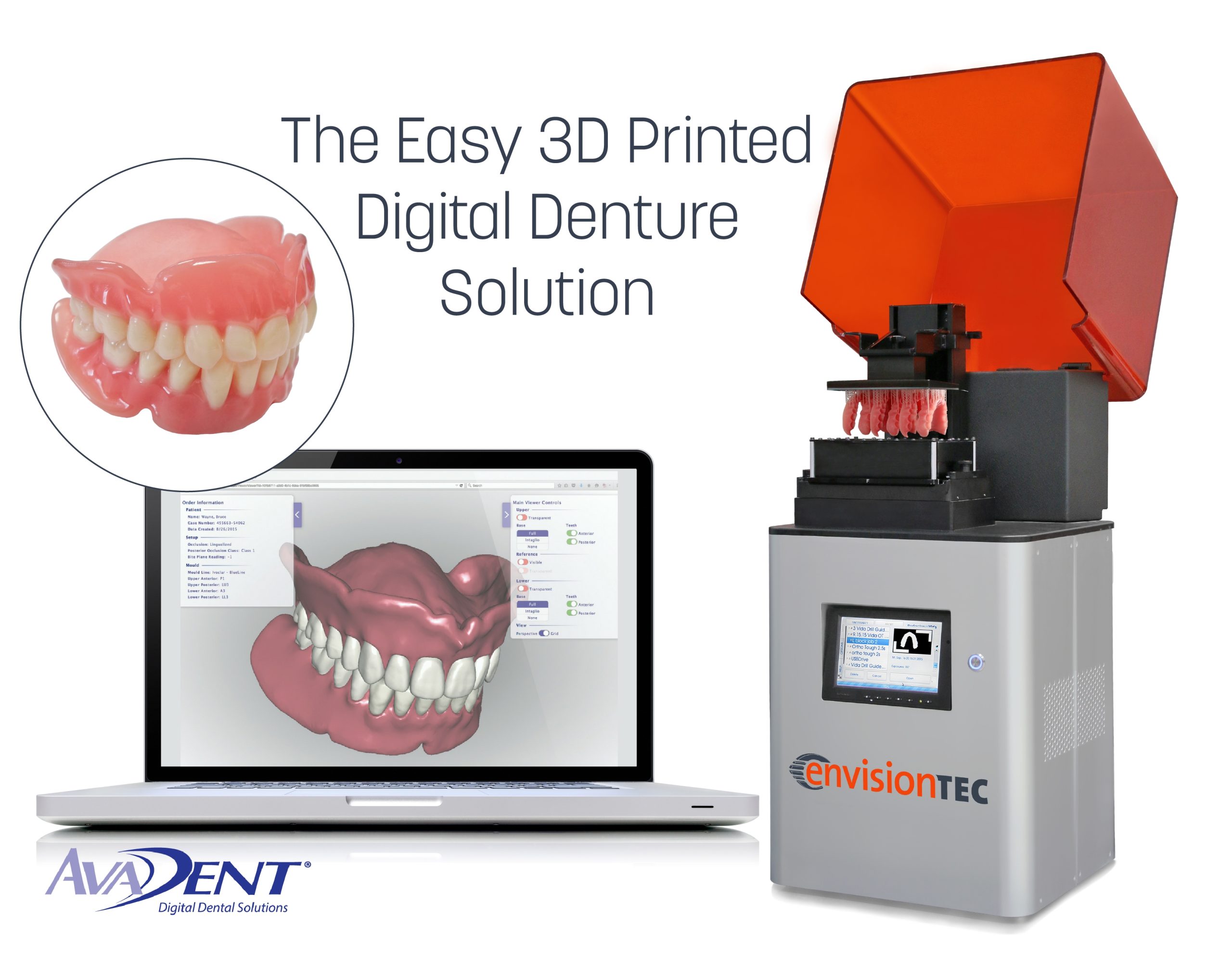 Navigating the New Wave of Digital Dentures: What You Should Know